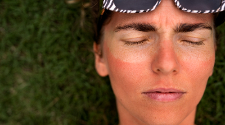 Sunburn: Causes, Symptoms And When To See A Doctor