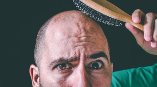 Hair Loss In Men And How To Reverse It
