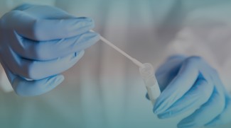 PCR Tests Price In Abu Dhabi Reduced